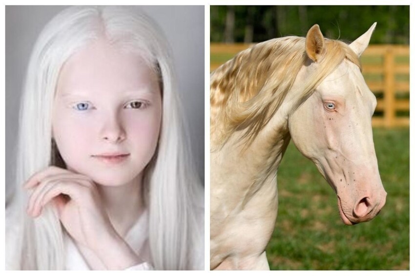 Иногда альбиносам необходимо хирургическое вмешательство, в частности для коррекции глазодвигательных мышц при косоглазии, которое часто встречается у альбиносов.