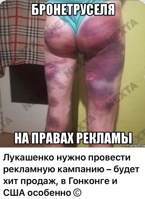 Как загар, по границе трусов.