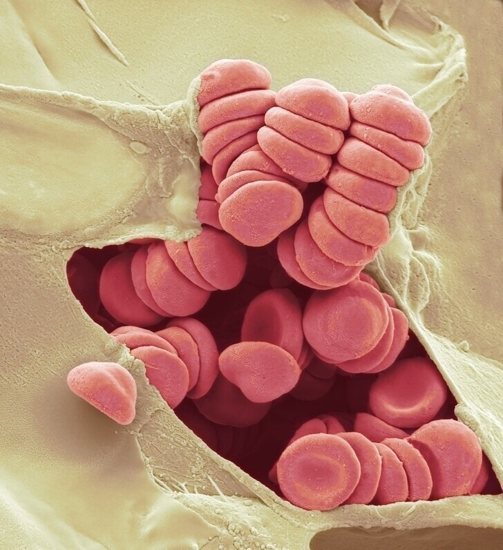 Так выглядит порез пальца под электронным микроскопом