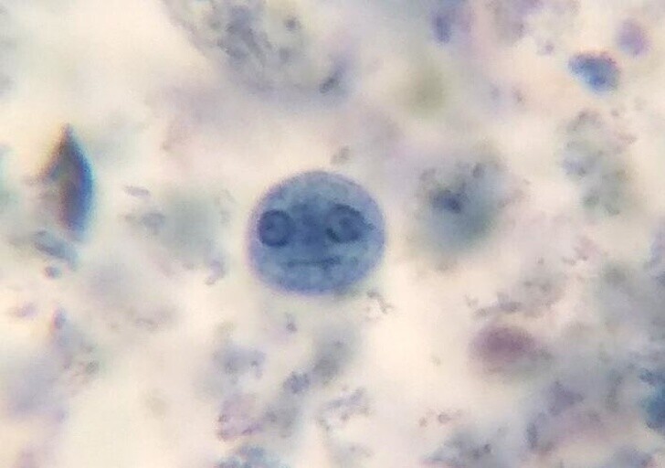 3. Амеба через микроскоп выглядит, как лицо