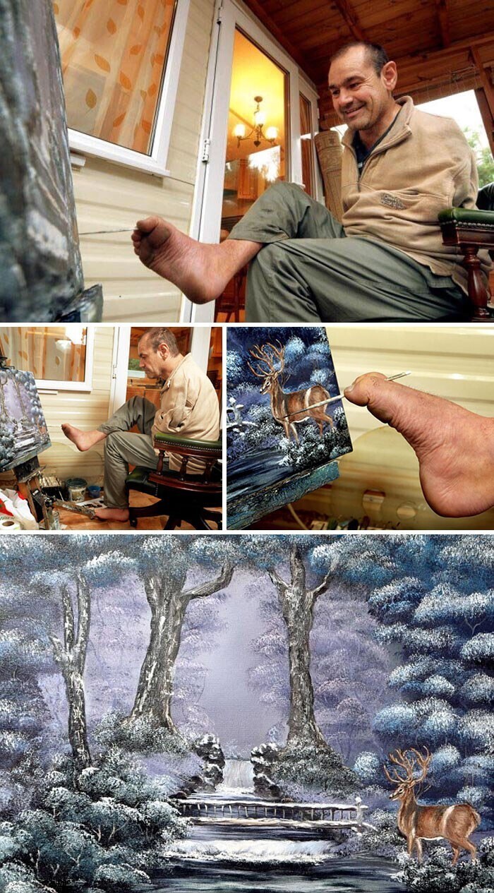 Питер Лонгстафф родился без рук — это результат того, что его мама принимала талидомид во время беременности. При этом он сам никогда не считал себя инвалидом и научился писать прекрасные картины, держа кисть пальцами ног.