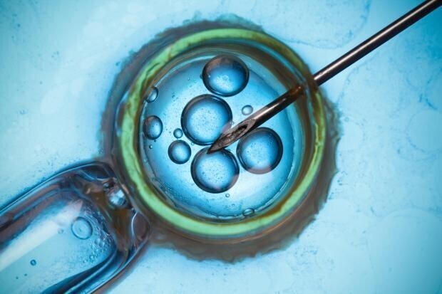 Донор спермы подал в суд на клинику, передавшую его биоматериал однополым парам