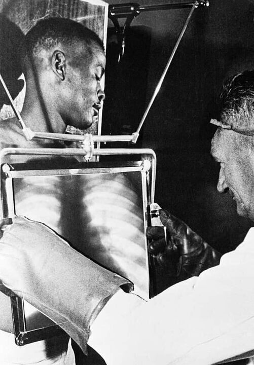 Алмазная шахта в ЮАР, 1954 год. Рентгенолог проверяет шахтёров на наличие алмазов в желудке.
