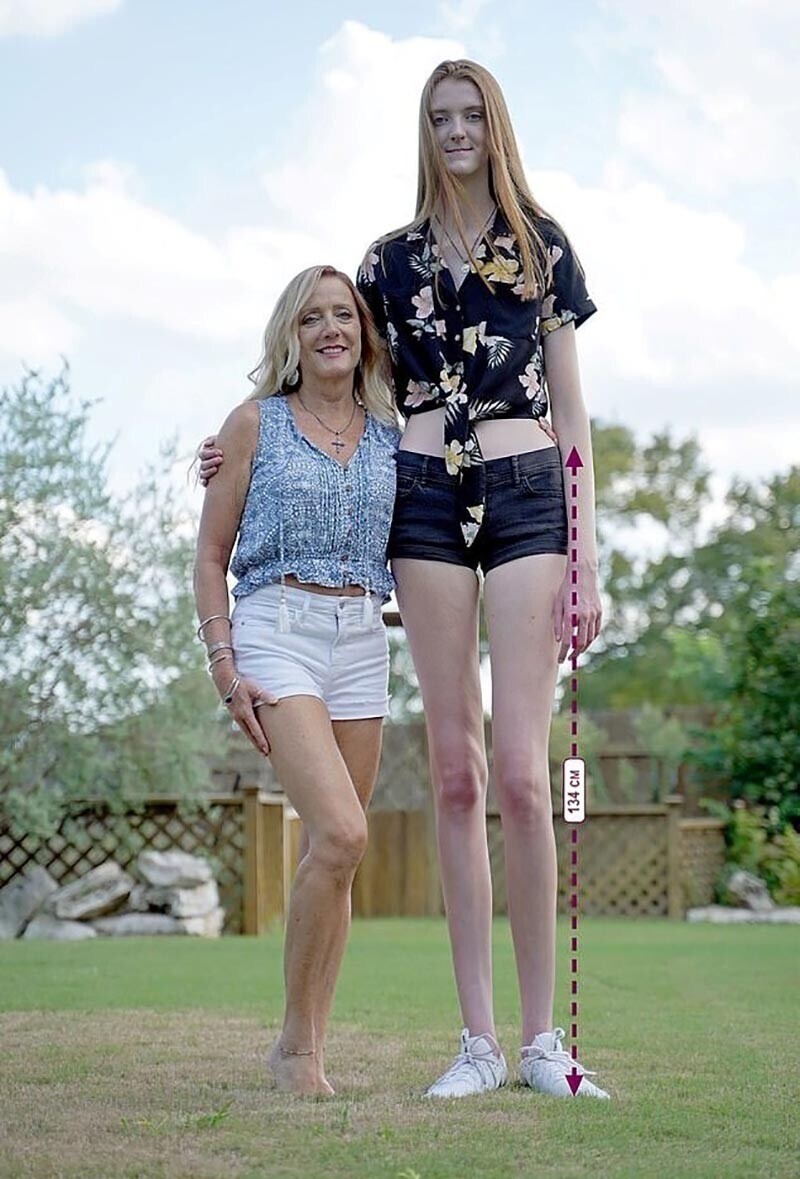 Мэйси Каррин обладательница самых  длинных ног в мире
