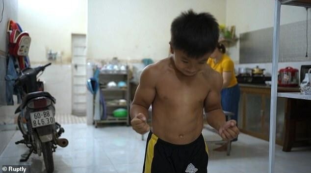 Супербой: 10-летний мальчик с редким заболеванием выглядит как бодибилдер