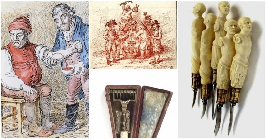 Кровь предков: история кровопускания и его значение в медицине прошлого