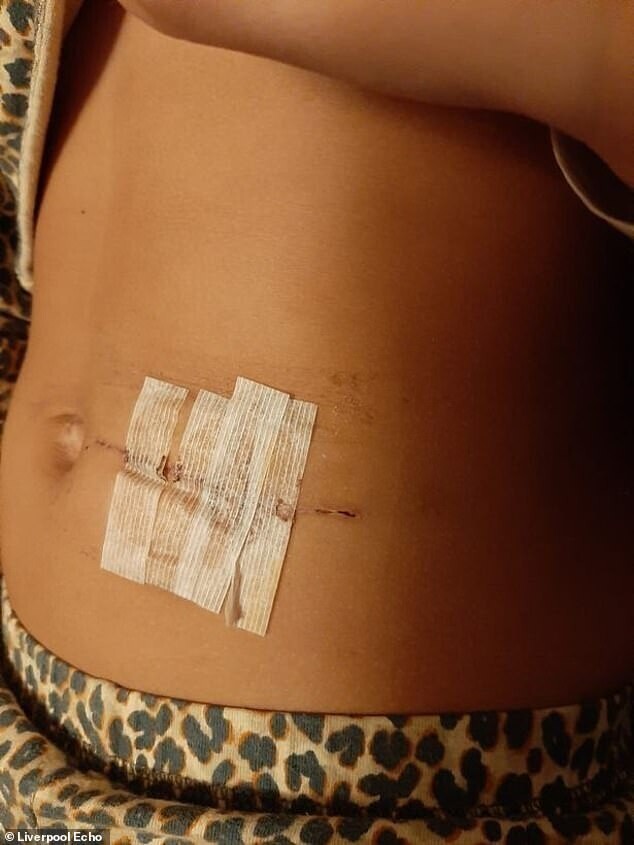 Из кишечника 10-летней девочки вытащили 15 магнитов