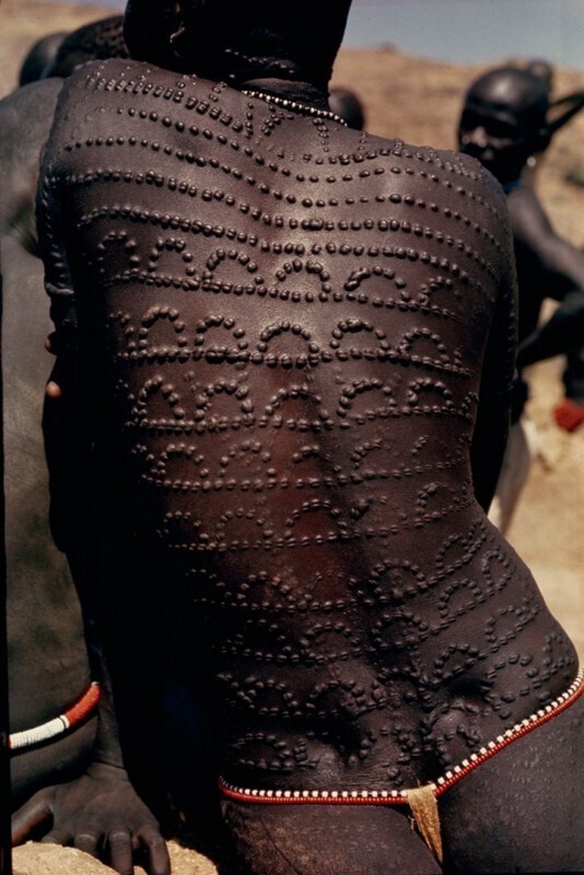 Рубцы от шрамирования (скарификации) в виде узора по всей спине суданской женщины, 1966