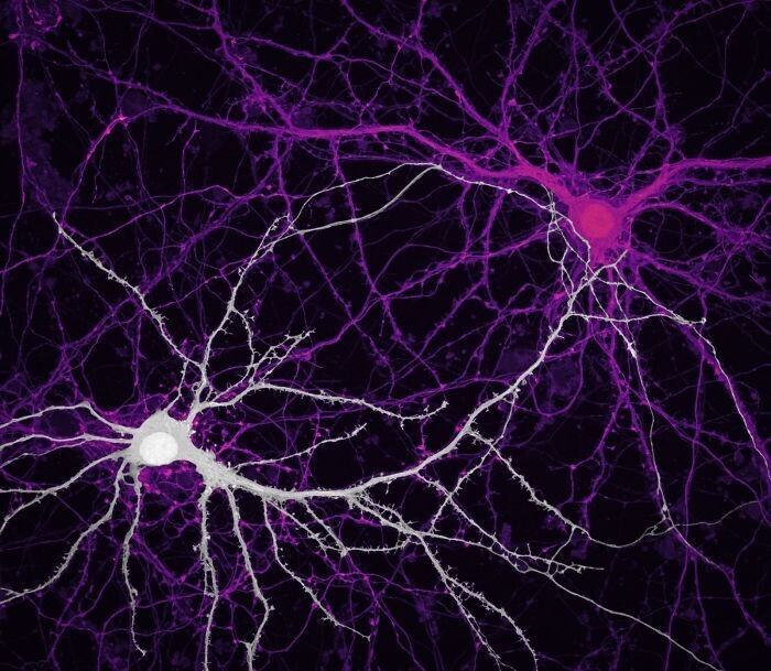 Связи между клетками мозга - нейронами гиппокампа, Jason Kirk