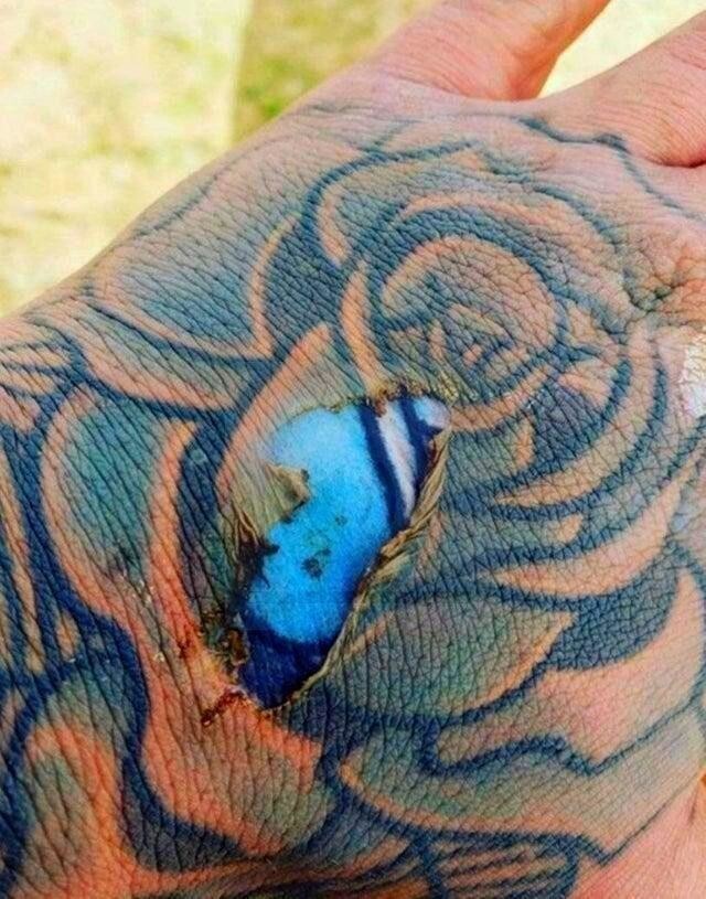 Что будет, если обгорит татуированная кожа? Рисунок освежится!
