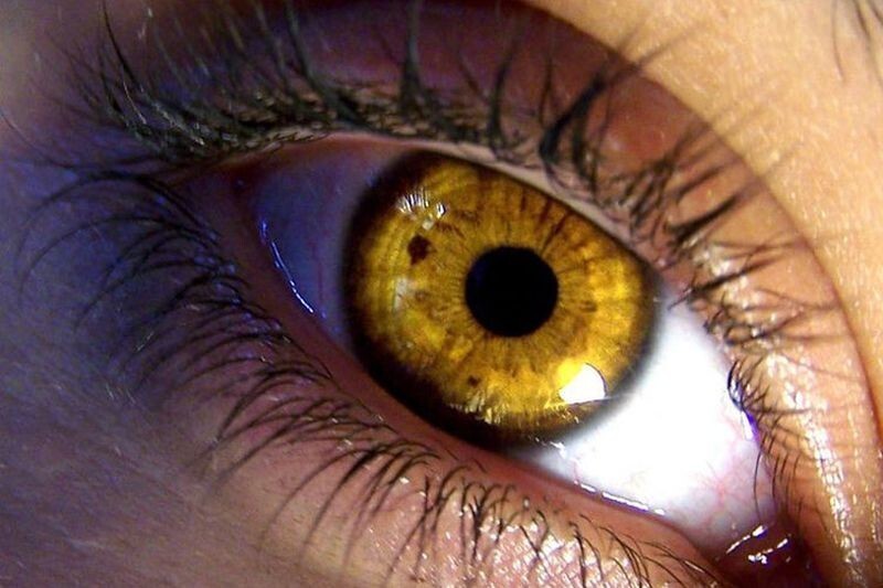 Желтый глаз 13. Болотный цвет глаз гетерохромия. Центральная гетерохромия карих глаз. Золотистый цвет глаз. Янтарный цвет глаз.