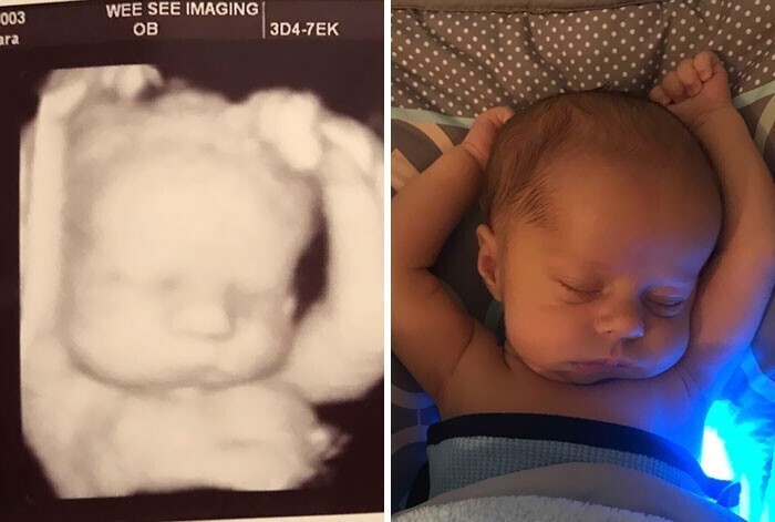 "Мой ребенок на УЗИ-снимке и через три недели после рождения"