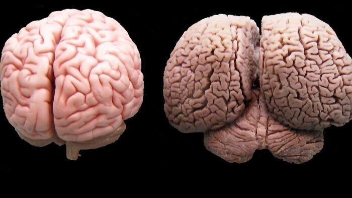 Мозг человека и мозг дельфина