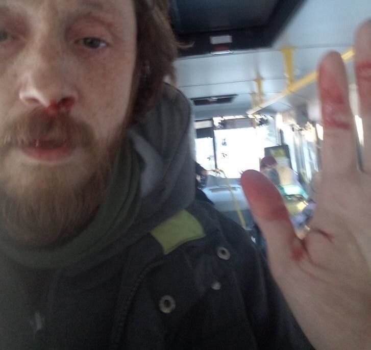 В Свердловской области водитель разбил нос пассажиру, неправильно надевшему маску