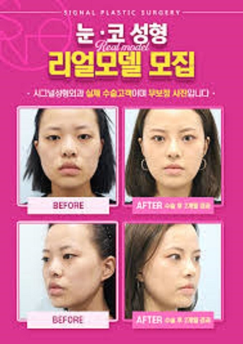Корейская индустрия красоты считается самой развитой во всем мире - ежегодно здесь проводят миллионы операций по исправлению внешности