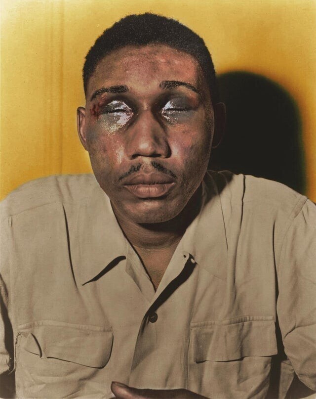 Исаак Вудард, награжденный афроамериканский ветеран Второй мировой войны, 12 февраля 1946 года, через несколько часов после увольнения из армии США, подвергся нападению полиции Южной Каролины. Мужчина остался слепым