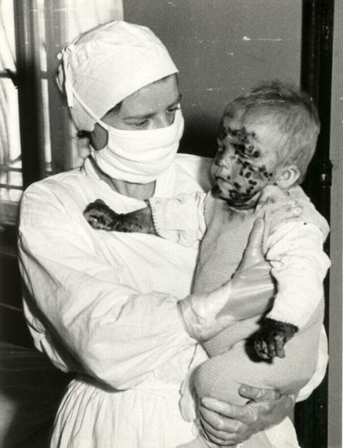 37. Медсестра с больным ребенком во время эпидемии оспы. Вроцлав, Польша, 1963 год
