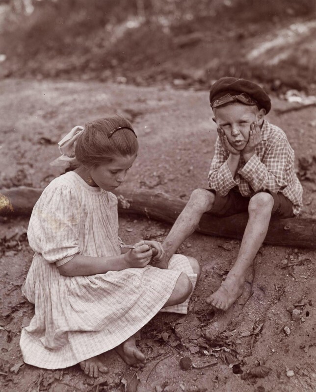 Старшая сестра достает занозу, 1910 год.