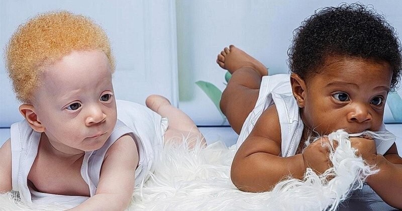 Женщина родила черного и абсолютно белого ребенка: как отреагировал отец (7 фото)