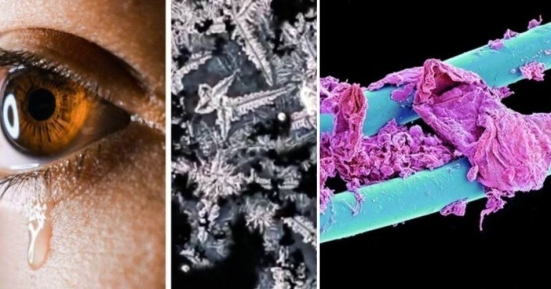 15 поразительных фото, которые демонстрируют некоторые вещи под микроскопом