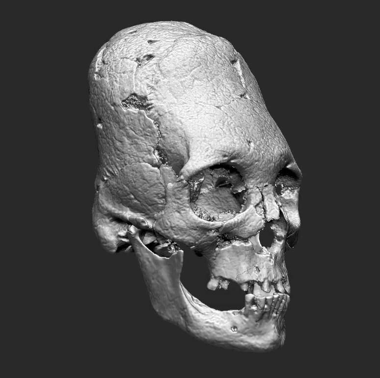 На фото: компьютерная модель черепа умершей 2500 лет назад бургундки.