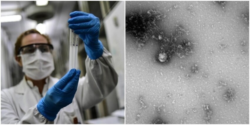 Российские учёные первые сфотографировали "британский" штамм коронавируса
