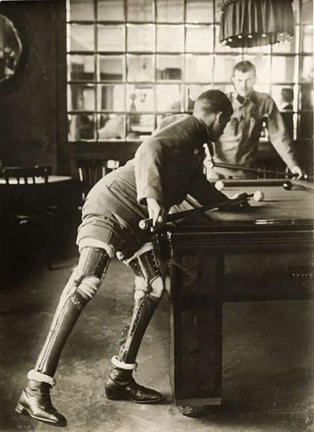 Солдат, потерявший обе ноги играет в бильярд. Первая мировая. 1915 год