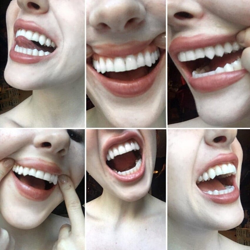 Почти все мои зубы выглядят как клыки