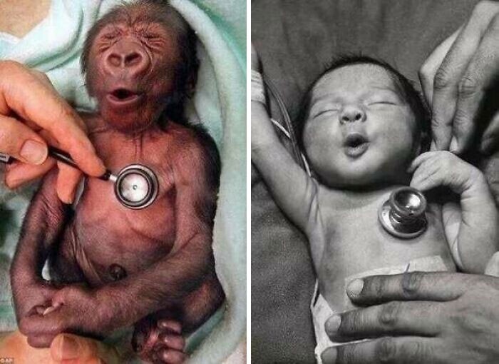 Как малыш гориллы и человека реагируют на холодный стетоскоп