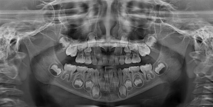"Я дантист, но рентгеновские снимки детей 6-12 лет меня немного пугают до сих пор"