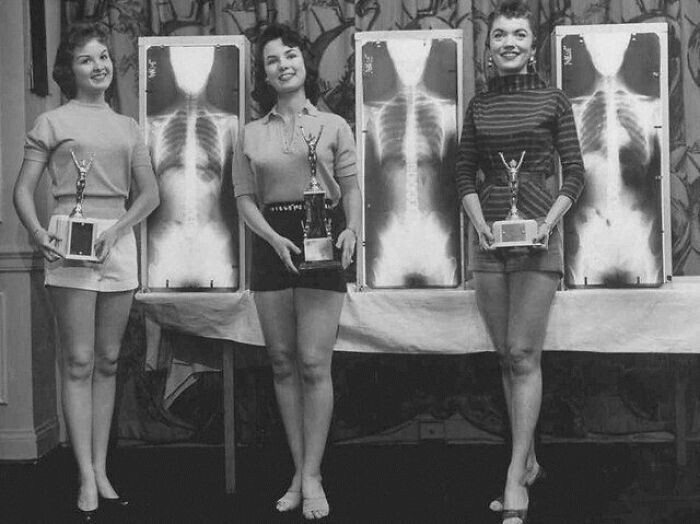 Конкурс "Мисс идеальная осанка" в Чикаго, 1956 год. По условиям конкурса, участницы предъявляли свои рентгеновские снимки