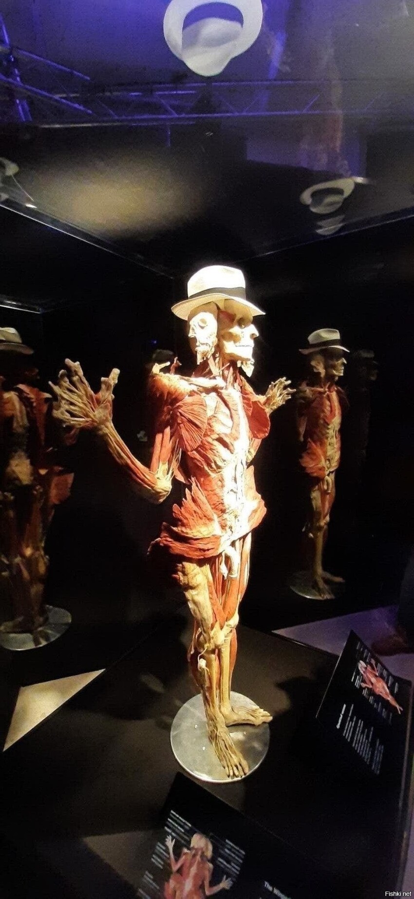 Был на выставке body worlds