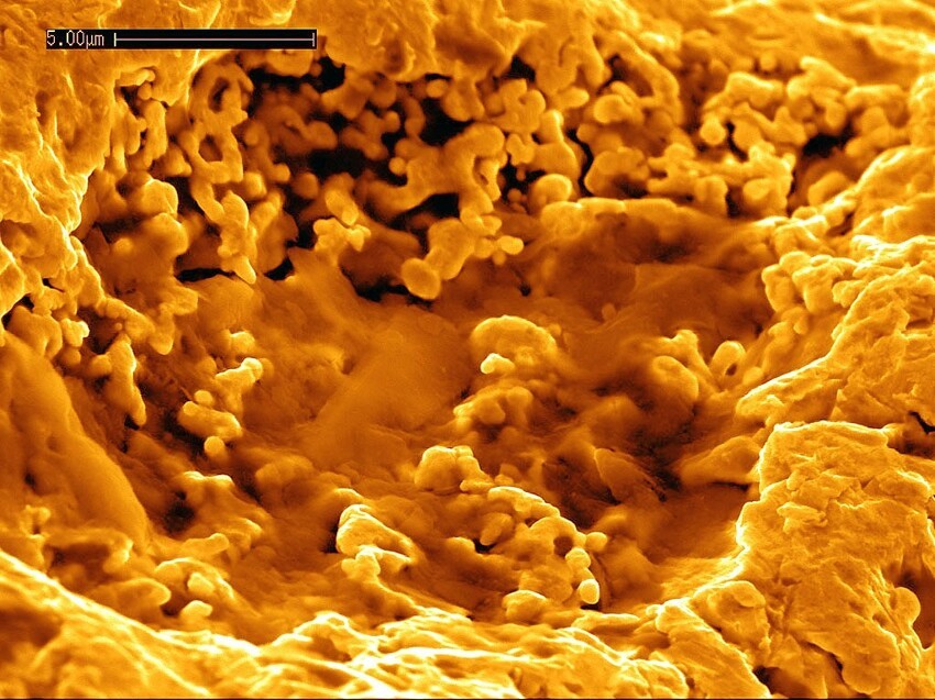 Cupriavidus metallidurans — неспорообразующая грамотрицательная бактерия (Металлотолерантный организм), которая эволюционно адаптировалась к высоким концентрациям ионов тяжёлых металлов во внешней среде