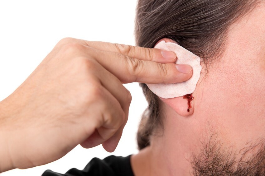 Механические повреждения как причины кровотечения из уха
