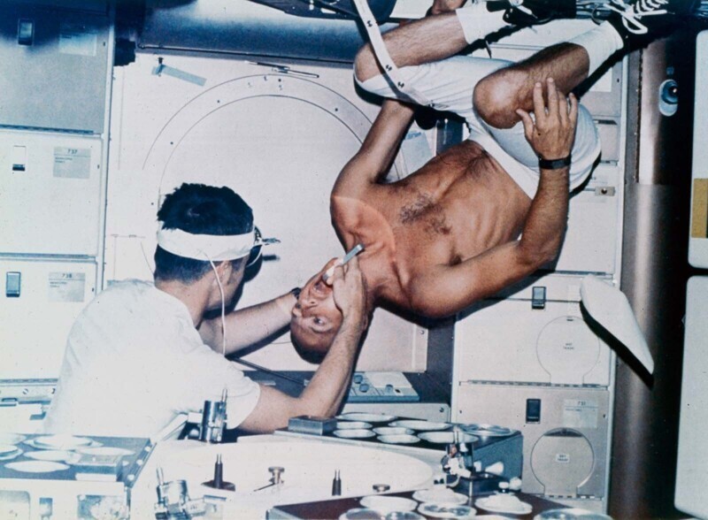 Астронавт Джозеф Кервин осматривает Чарльза Конрада во время первого пилотируемого полета на "Скайлэб", 1973 г.