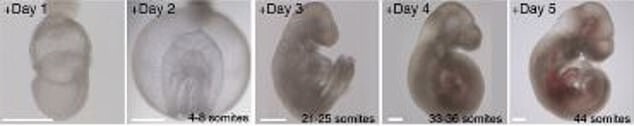 Как выглядит эмбрион 5 дней при эко фото