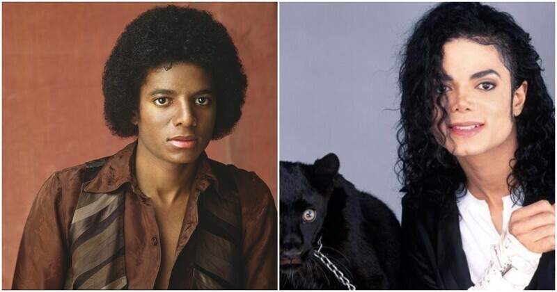 Кардинальная перемена во внешности Майкла Джексона кроется в витилиго
