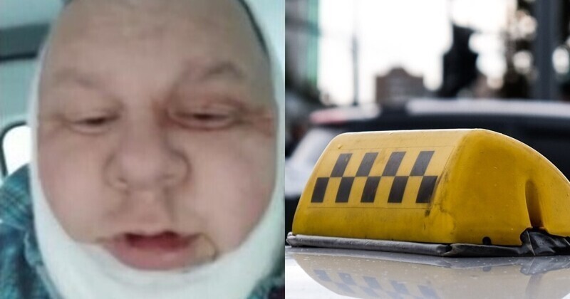 Барнаульский таксист выжил благодаря второму подбородку после того, как неизвестные перерезали ему горло