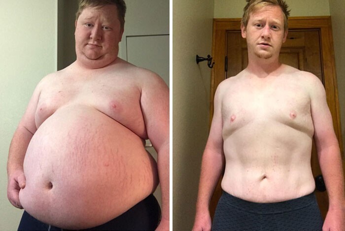 "Сбросил за год 90 килограммов: придерживался диеты и проходил по 5 километров в день"