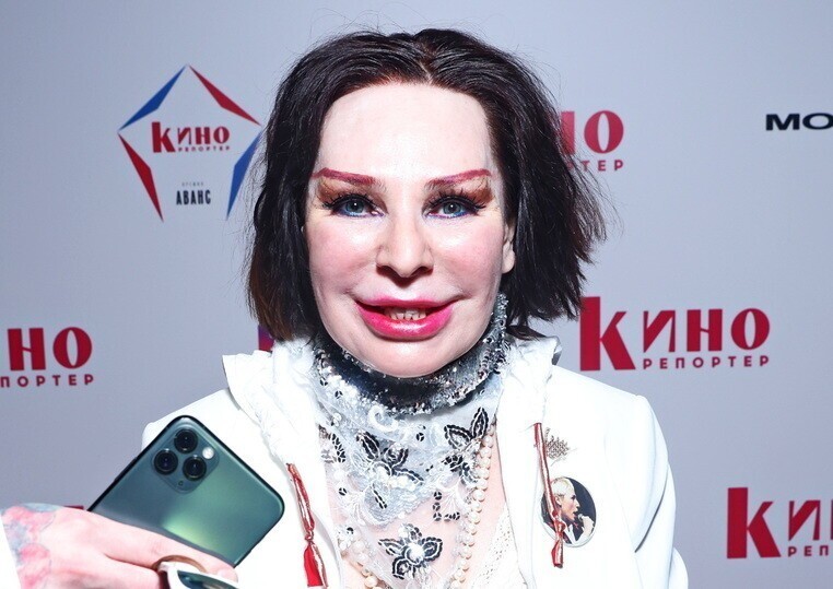 Жанна Агузарова после пластики стала выглядеть странно