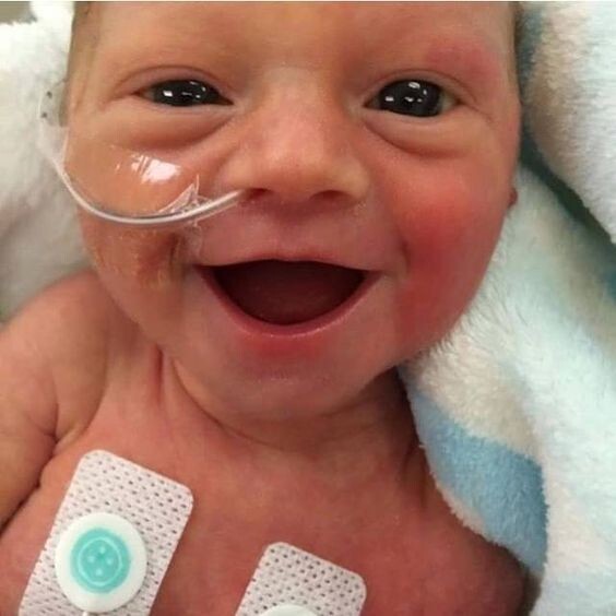 Малыш родился раньше времени, и прошёл длительную терапию. Это его первая улыбка