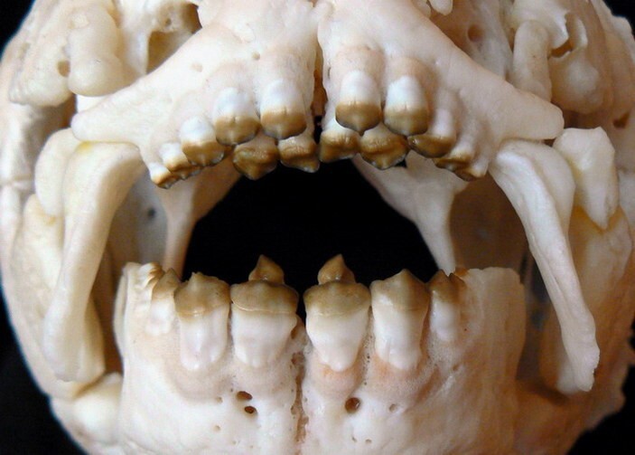 Зубы бурого паку (Colossoma macropomum), пираньевые