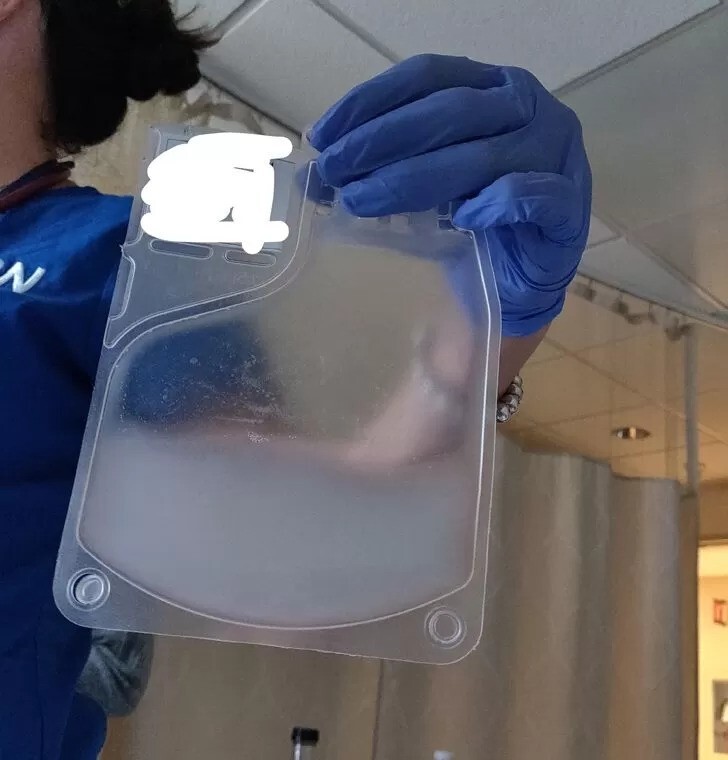 Упаковка белых кровяных телец, отредактированных в генной лаборатории так, чтобы увеличить шансы пациента в борьбе с раком.