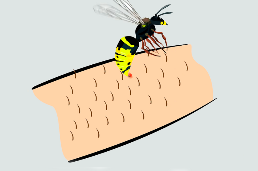 10 укусов насекомых, которые нужно уметь распознавать