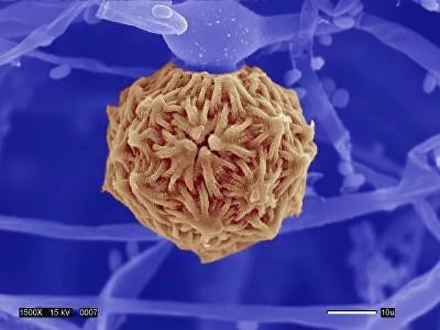 Зигоспора патогенного грибка Mucor circinelloides
