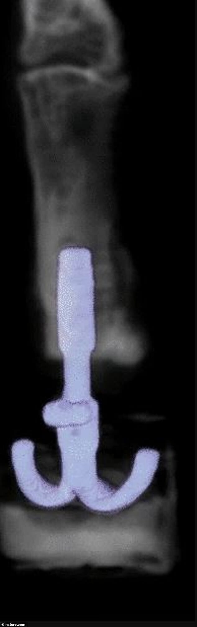 Рентген лапы грифа с интегрированным в кость протезом