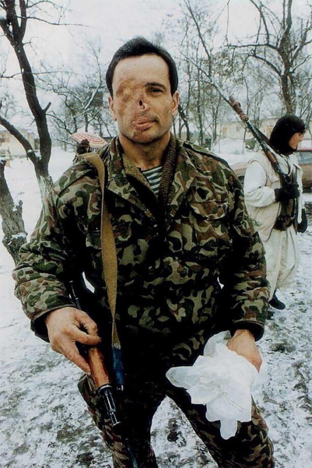 Полевой командир ЧРИ Муса Басханов, 1995 год. Среди чеченцев получил прозвище "киборг" за свой страшный шрам на лице.