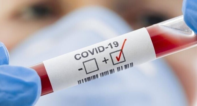 Кремль не поддержал идею закрытия границ регионов из-за COVID-19