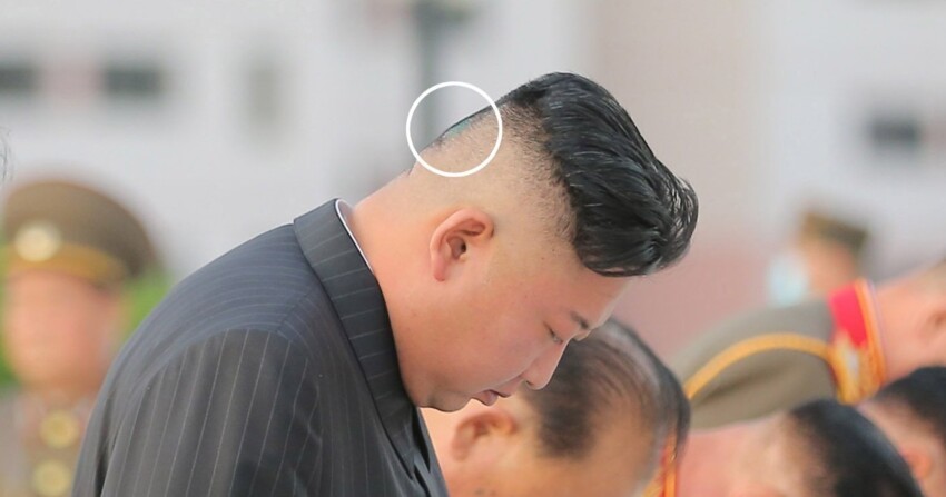 Журналисты заметили на голове Ким Чен Ына лейкопластырь и испугались за его здоровье