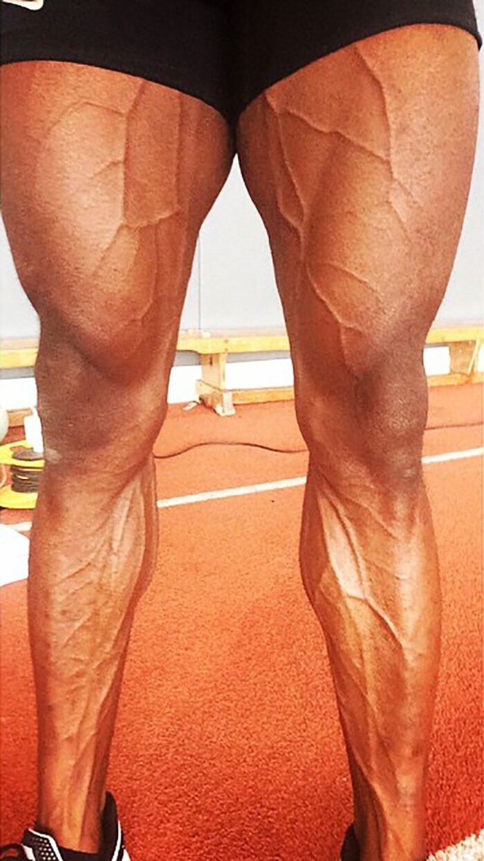 Ноги легкоатлета после предолимпийской тренировки